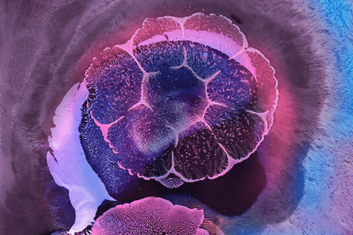 Vibrant microscope image of a bacterial colony in purple and pink tones, representing the gut microbiome